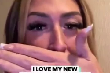 Se hizo una megadentadura en Turquía y su sonrisa se volvió viral