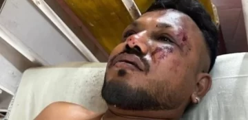 El único sobreviviente del avión caído en India contó cómo logró salir con vida